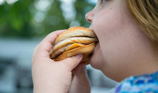  In Moscow, obesity is on the rise due to Russians’ changing dietary habits. WHO /Sergey Volkov
